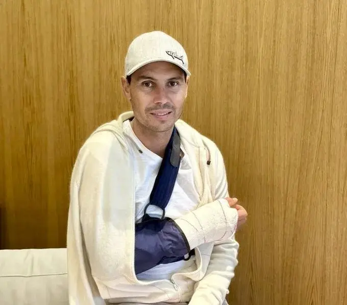 Nadal Operado por Artrosis Severa en Mano Derecha: Detalles de la Intervención