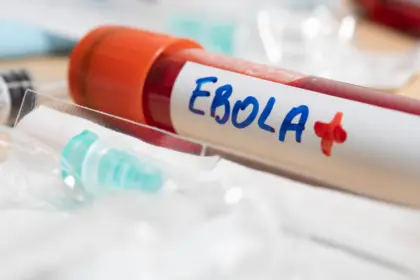 Crisis por ébola en el Congo: epidemia imparable y falta de fondos