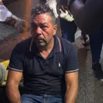 Accidente en Salcedo deja hombre herido con fracturas en ambas piernas