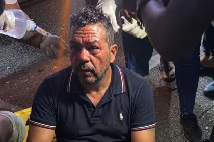 Accidente en Salcedo deja hombre herido con fracturas en ambas piernas