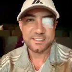 Marcos Yaroide operado de emergencia por desprendimiento de retina