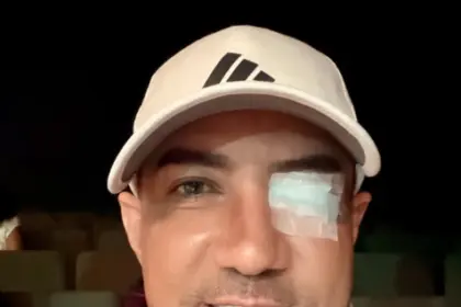 Marcos Yaroide operado de emergencia por desprendimiento de retina