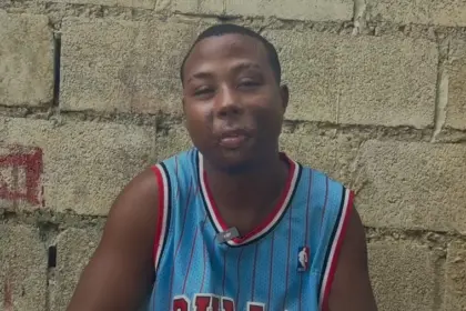 Joven de Sabana Grande de Boyá clama ayuda para costosas cirugías reconstructivas
