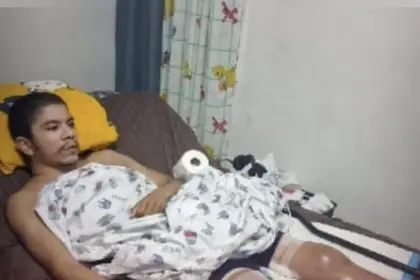 Piden ayuda para joven de Invivienda con enfermedad poco frecuente 13 Piden ayuda para joven de Invivienda con enfermedad poco frecuente