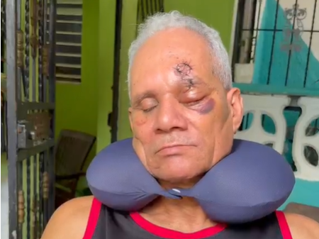 Hombre pierde ojo tras brutal agresión en La Guáyiga y exige justicia