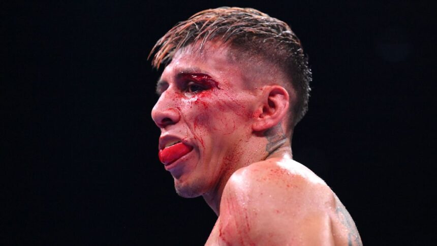 Rodriguez Jr. in Trouble: Victory Against Yafai Questioned Due to Anti-Doping Test
