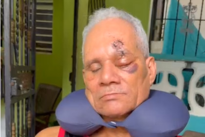 Man loses eye after brutal assault in La Guáyiga and demands justice