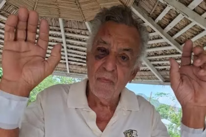 Tobacco businessman is brutally beaten during assault in Altamira